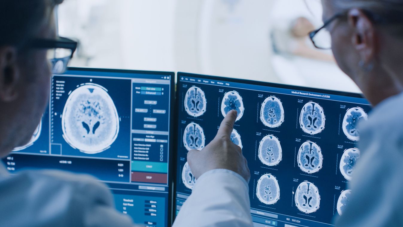 Hatalmas áttörést hozhat egy új szűrővizsgálat az Alzheimer-kór felismerésében