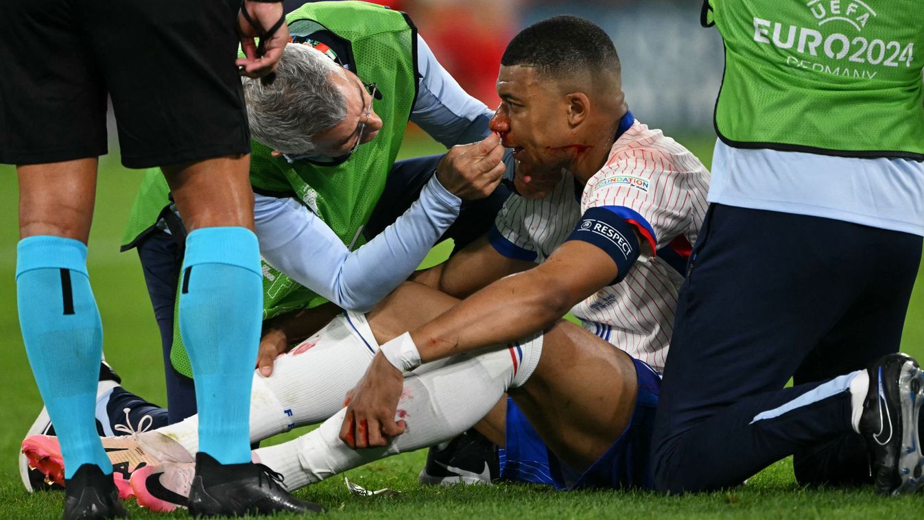 Mbappé imázskampányt csinál az orrtöréséből